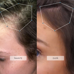 Ser Multi-Activ Creșterea Părului